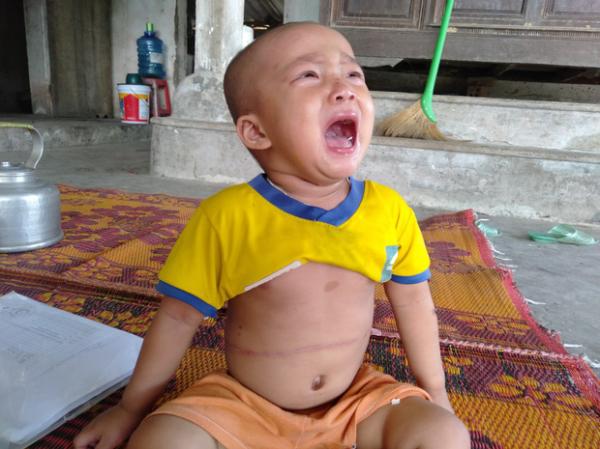 Tiếng khóc xé lòng của bé gái 3 tuổi mắc bệnh hiểm nghèo: “Bà ơi, cháu đau lắm, sao bố mẹ mãi không về hả bà?”
